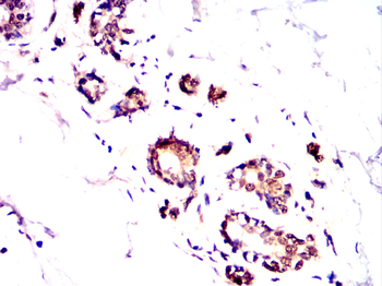 RPS6KB2 Antibody