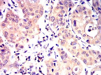 RPS6KB2 Antibody