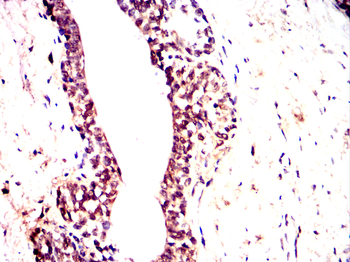RPS6KB2 Antibody