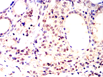 RPS6KB2 Antibody