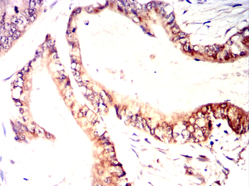 TGM2 Antibody