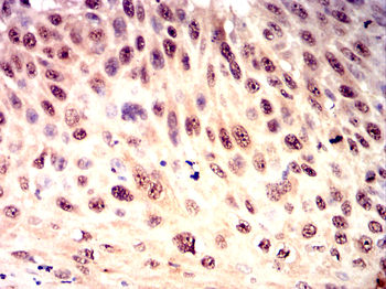 LGALS3 Antibody