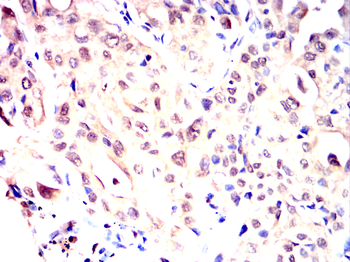 FKBP5 Antibody