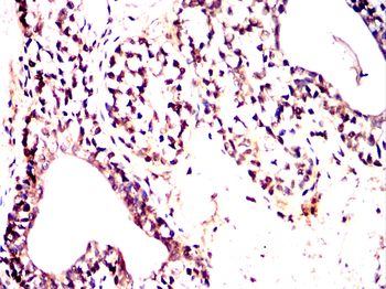 FKBP5 Antibody
