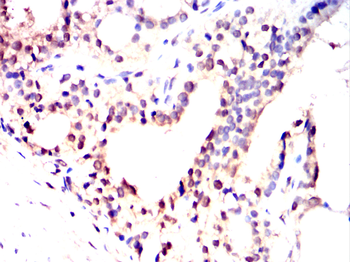 FKBP5 Antibody