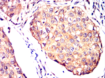 IKBKG Antibody