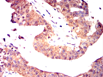 IKBKG Antibody