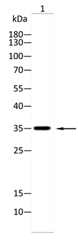 ACVR1B Antibody
