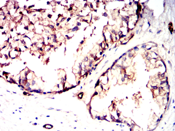 DPYSL2 Antibody