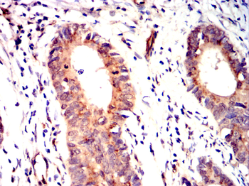 DPYSL2 Antibody