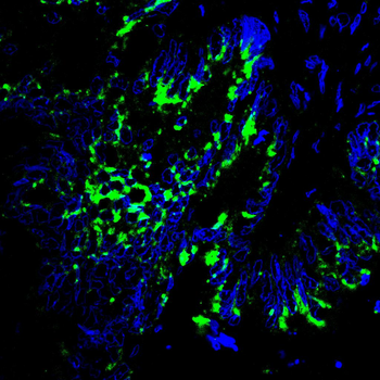 STK39 Antibody
