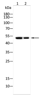 IL6R Antibody