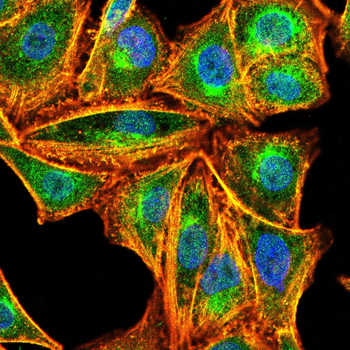 AKT2 Antibody