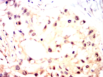 AKT2 Antibody