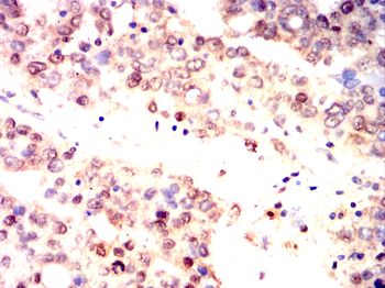 AKT2 Antibody