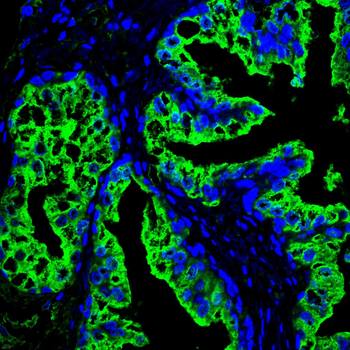 KLK2 Antibody