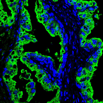 KLK2 Antibody