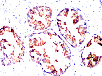 KLK2 Antibody