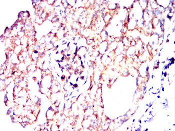 USP14 Antibody