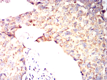 ACADM Antibody