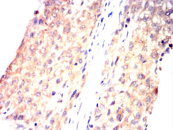 TRBC1 Antibody