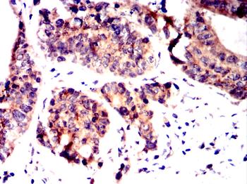 RCHY1 Antibody