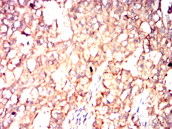 FLT4 Antibody