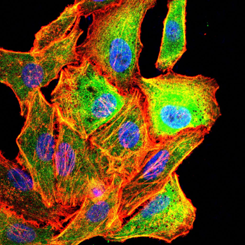 ERBB2 Antibody