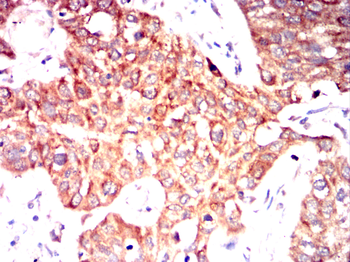 CSK Antibody
