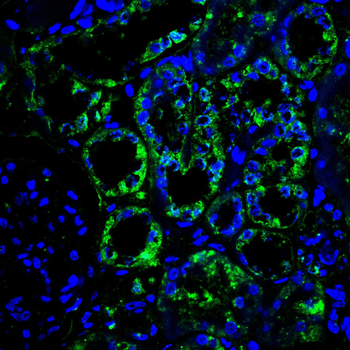 CSK Antibody