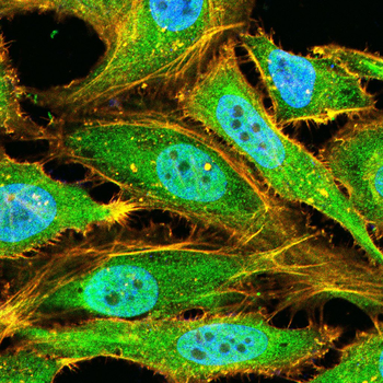 CTCF Antibody