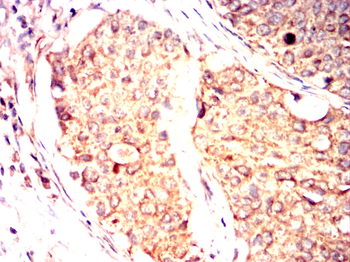 MAP2K4 Antibody
