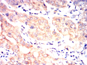MAP3K5 Antibody