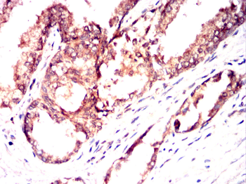 MAP3K5 Antibody