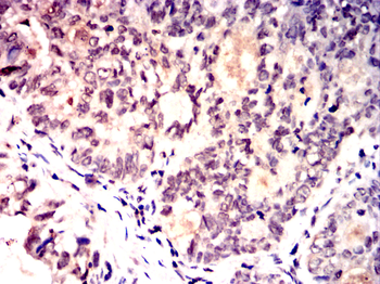 CRKL Antibody