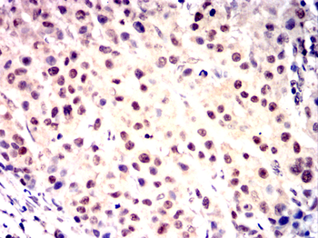 CRKL Antibody