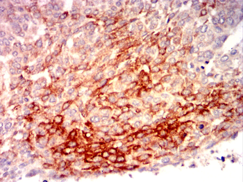 EIF2AK3 Antibody