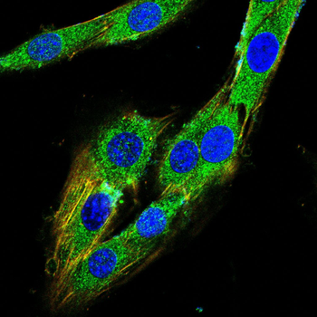 PDK1 Antibody