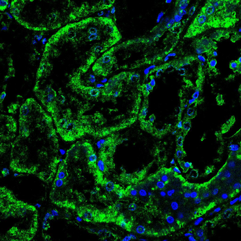 PDK1 Antibody