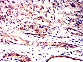 AURKB Antibody