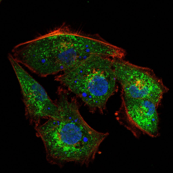 IGF2R Antibody