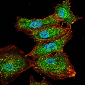 CARM1 Antibody
