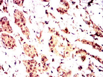 CARM1 Antibody