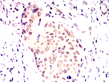 HDAC2 Antibody