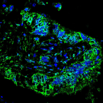 NGFR Antibody