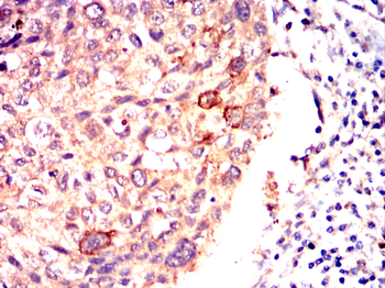 RAB21 Antibody