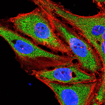 GKAP Rabbit Polyclonal Antibody