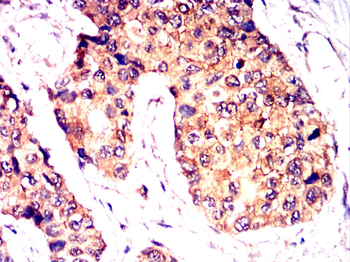 G6PD Antibody