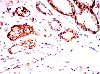 NQO1 Antibody