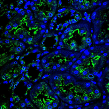 NQO1 Antibody